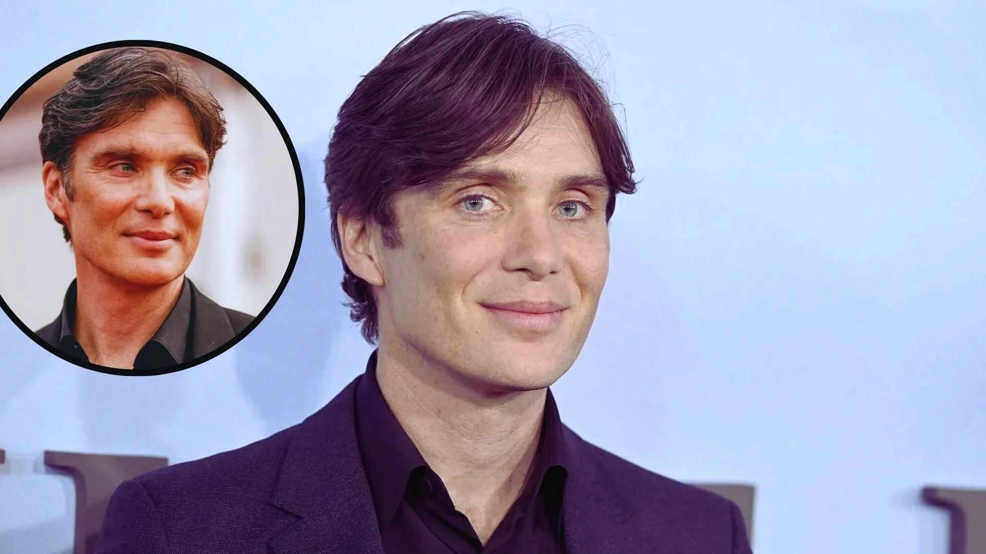 Cillian Murphy Plastic Surgery