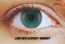Lens Replacement Surgery